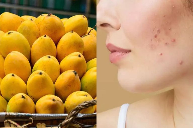 pimples-appear-on-face-after-eating-mango