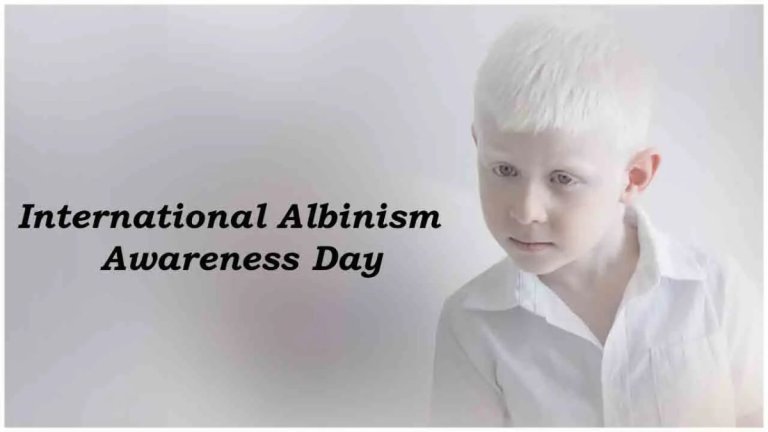 International Albinism Awareness Day today know its history